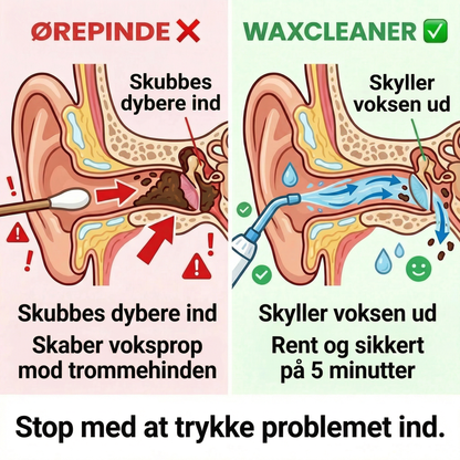 Waxcleaner – Enkel og effektiv ørerens på bare 5 minutter